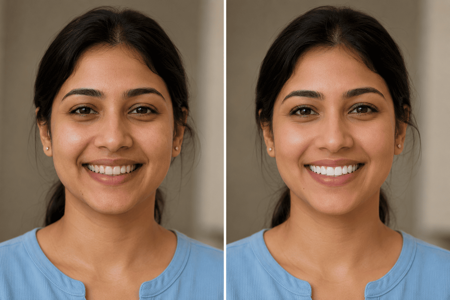 Comparison of ceramic and composite veneers for smile designing in Thane