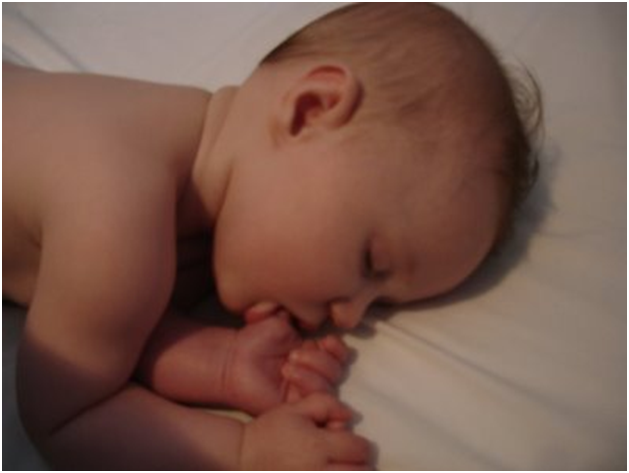 Thumb Sucking in Children and Its Management Treatment in Thane